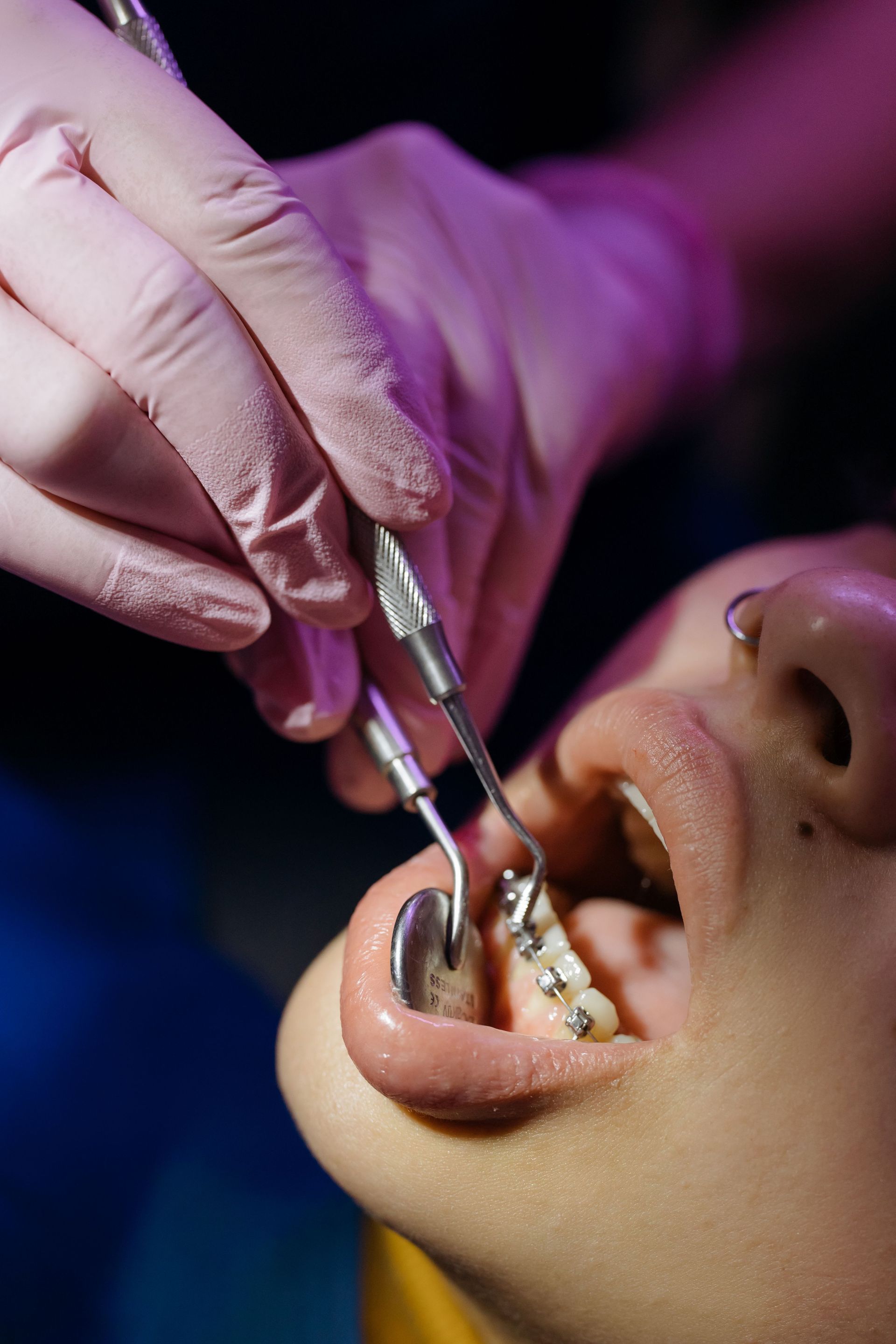 Un dentista examina la boca abierta de un paciente con instrumental dental bajo una intensa luz clínica