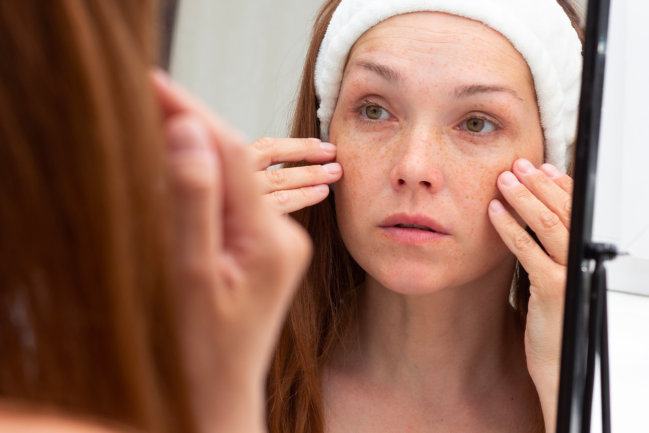 Una donna si applica dei prodotti per la cura della pelle del viso mentre si guarda allo specchio, indossando una fascia bianca tra i capelli.