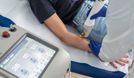 Una persona riceve un trattamento laser su un braccio accanto a un pannello di controllo medicale.