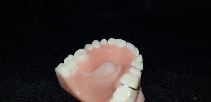 Denture — Goonellabah Denture Clinic In Goonellabah, NSW