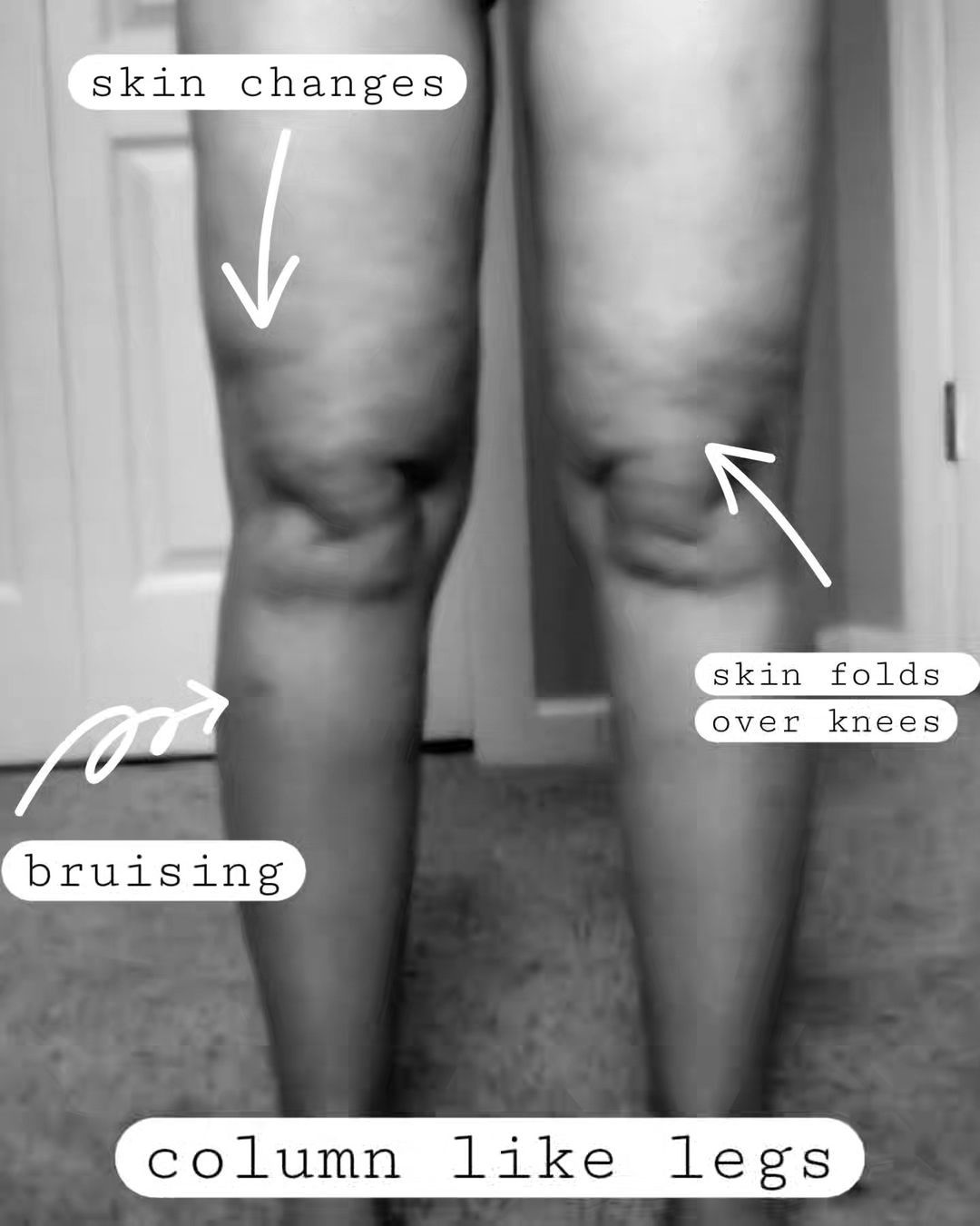 Do your legs look like these?