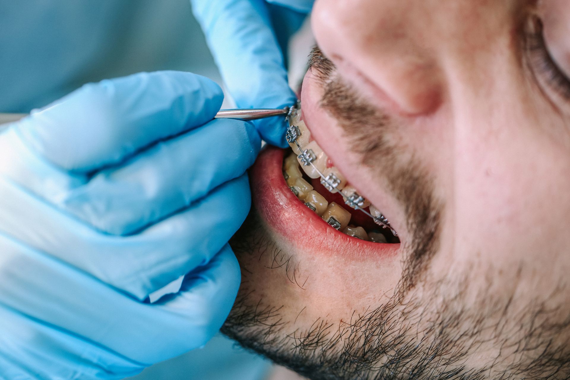 Orthodontist examining patients’ teeth.
