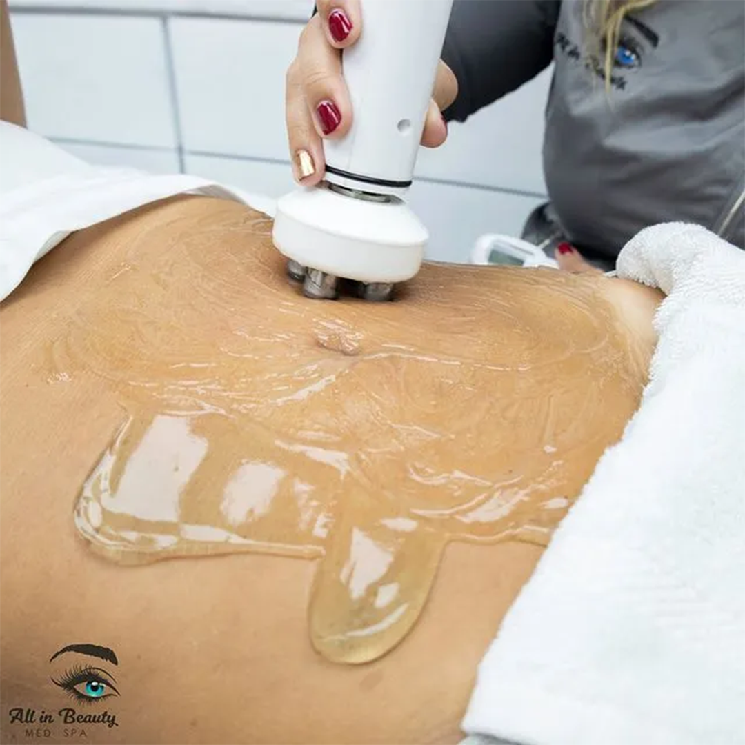 Woman receiving abdominal skin treatment with a device, covered in gel.