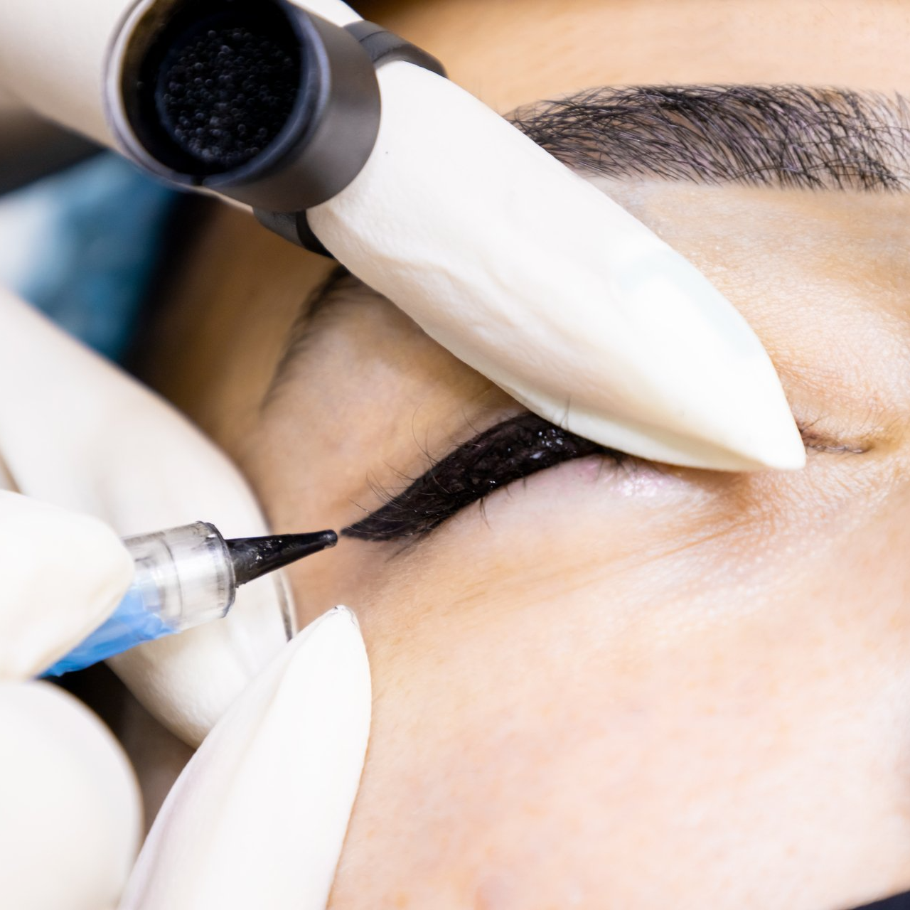 Eyeliner tattoo procedure: a person's eye being tattooed, black ink applied with a needle, close-up.