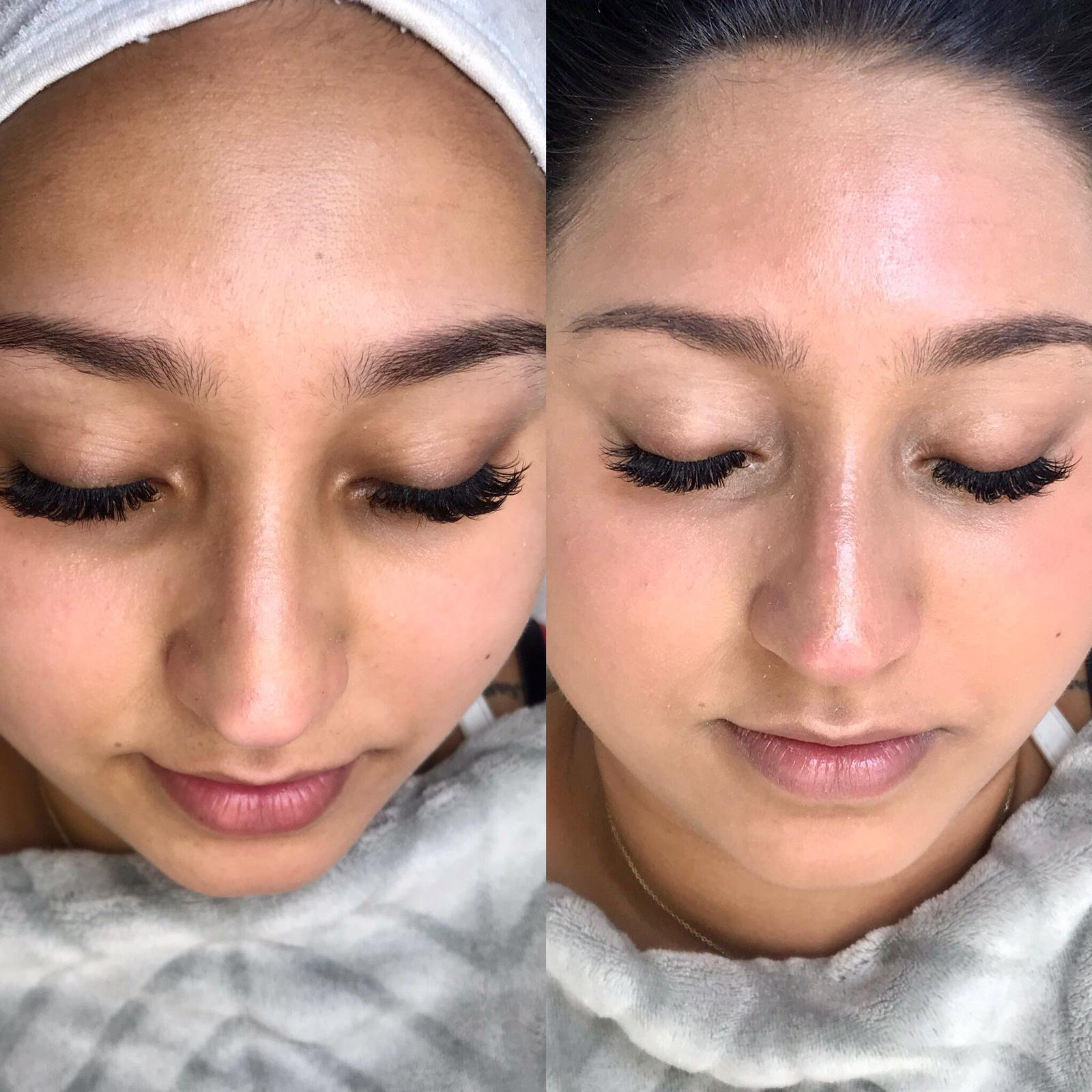 Side-by-side photos of a woman's face, showing before and after skincare treatment. Enhanced skin tone, with closed eyes.