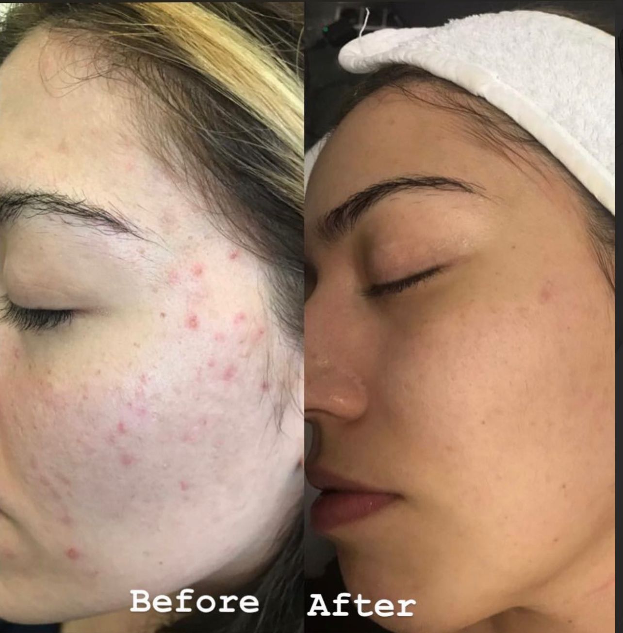 A before-and-after of a person's face. The 