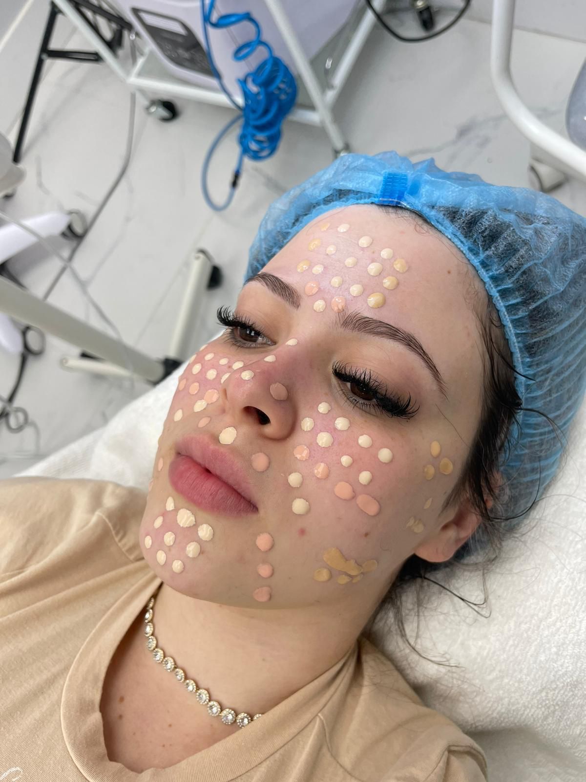 Woman's face with foundation dots, wearing a blue cap, lying on a treatment bed.