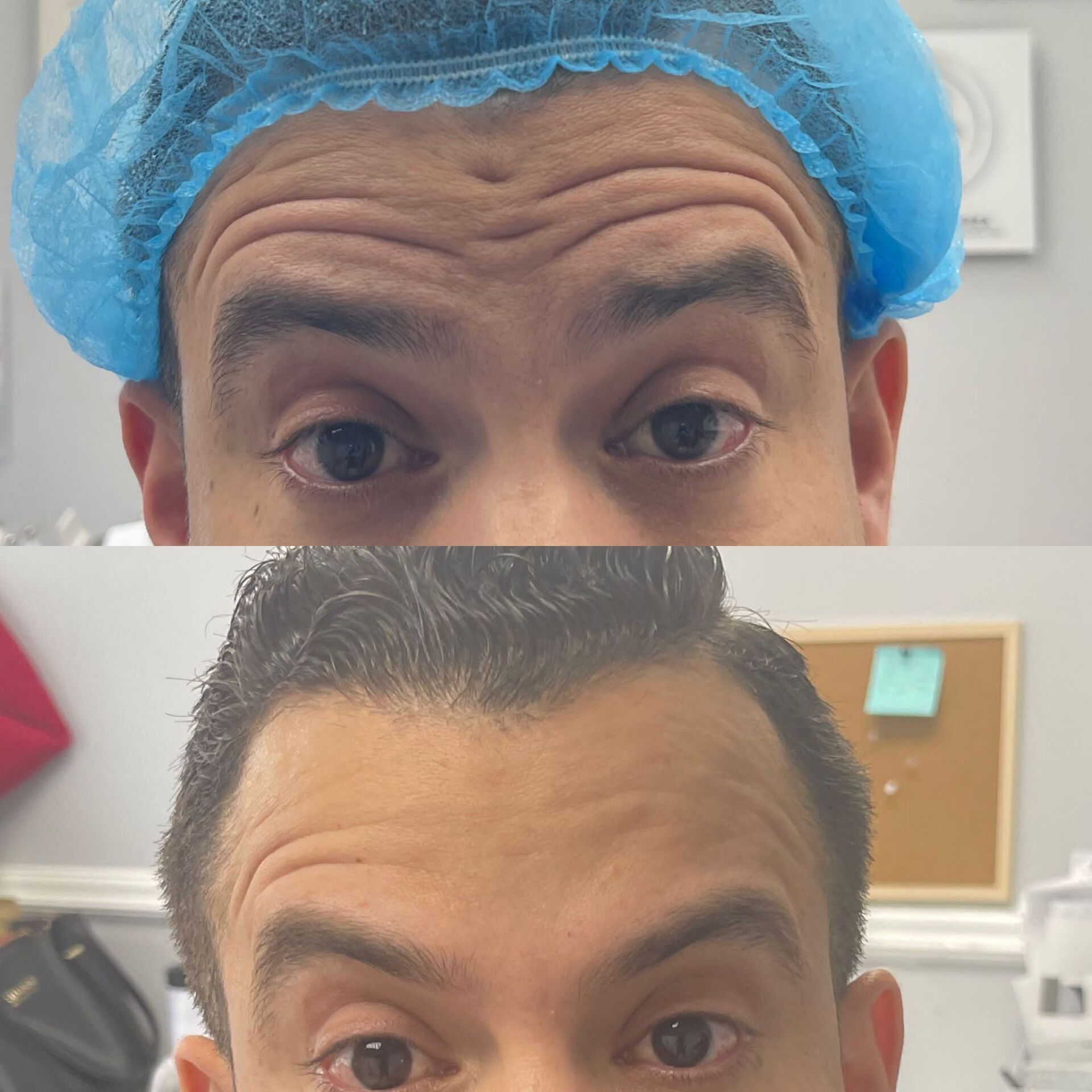 Top: Man with blue cap, furrowed brow. Bottom: Man with smoothed brow, neat hair.