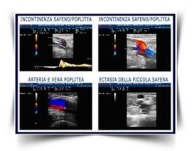 ecocolordoppler schema