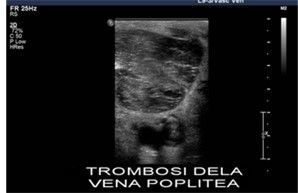 Quadri di TVP