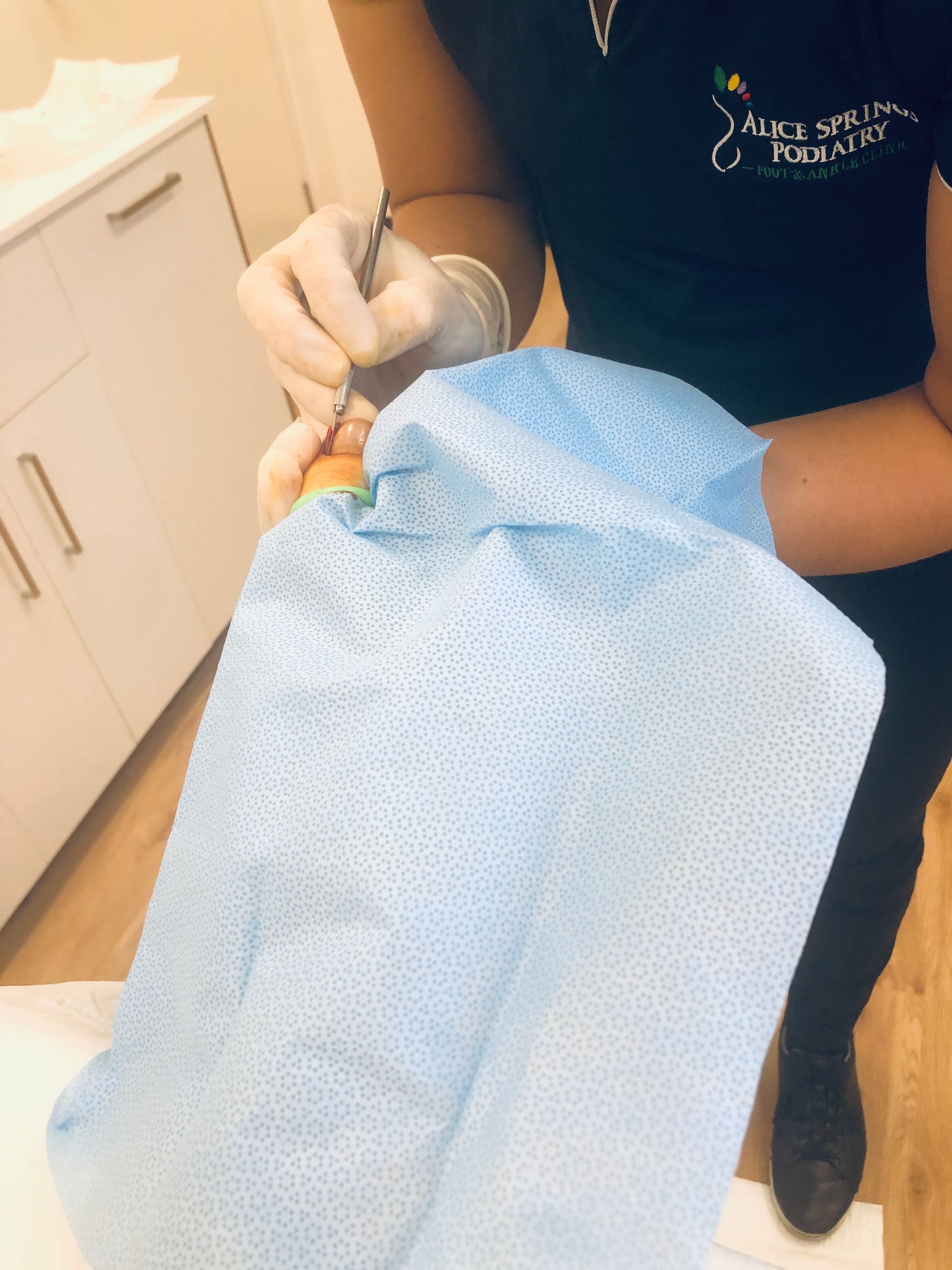Person wearing gloves holds surgical instrument over a patient's eye, who is draped in blue cloth. — Alice Springs Podiatry in Ciccone, NT