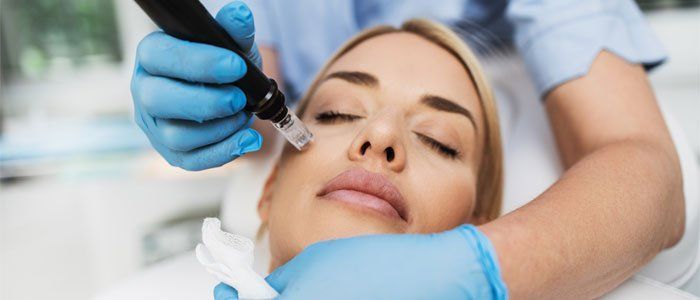 Woman receiving facial microneedling treatment, eyes closed, in a clinical setting.