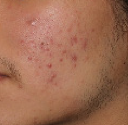 patient 1 before