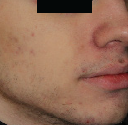 patient 2 after