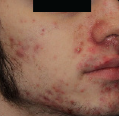 patient 2 before