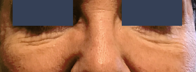 patient 1 before
