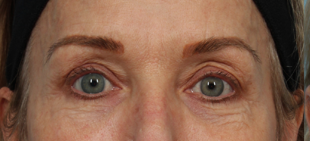 patient 1 before