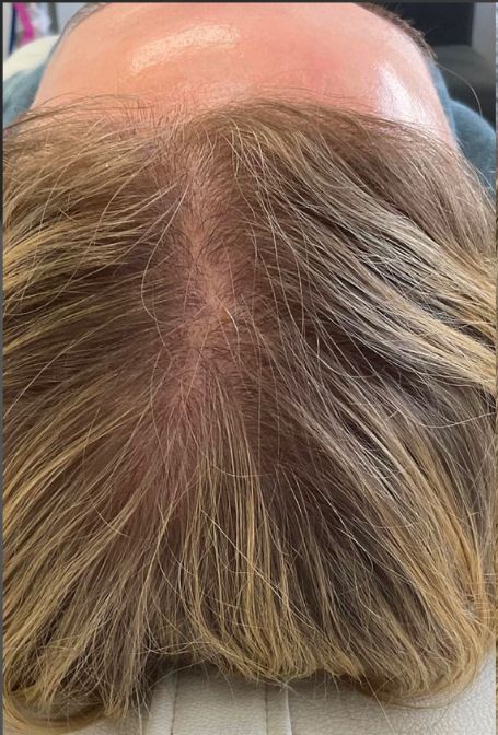 patient 1 before