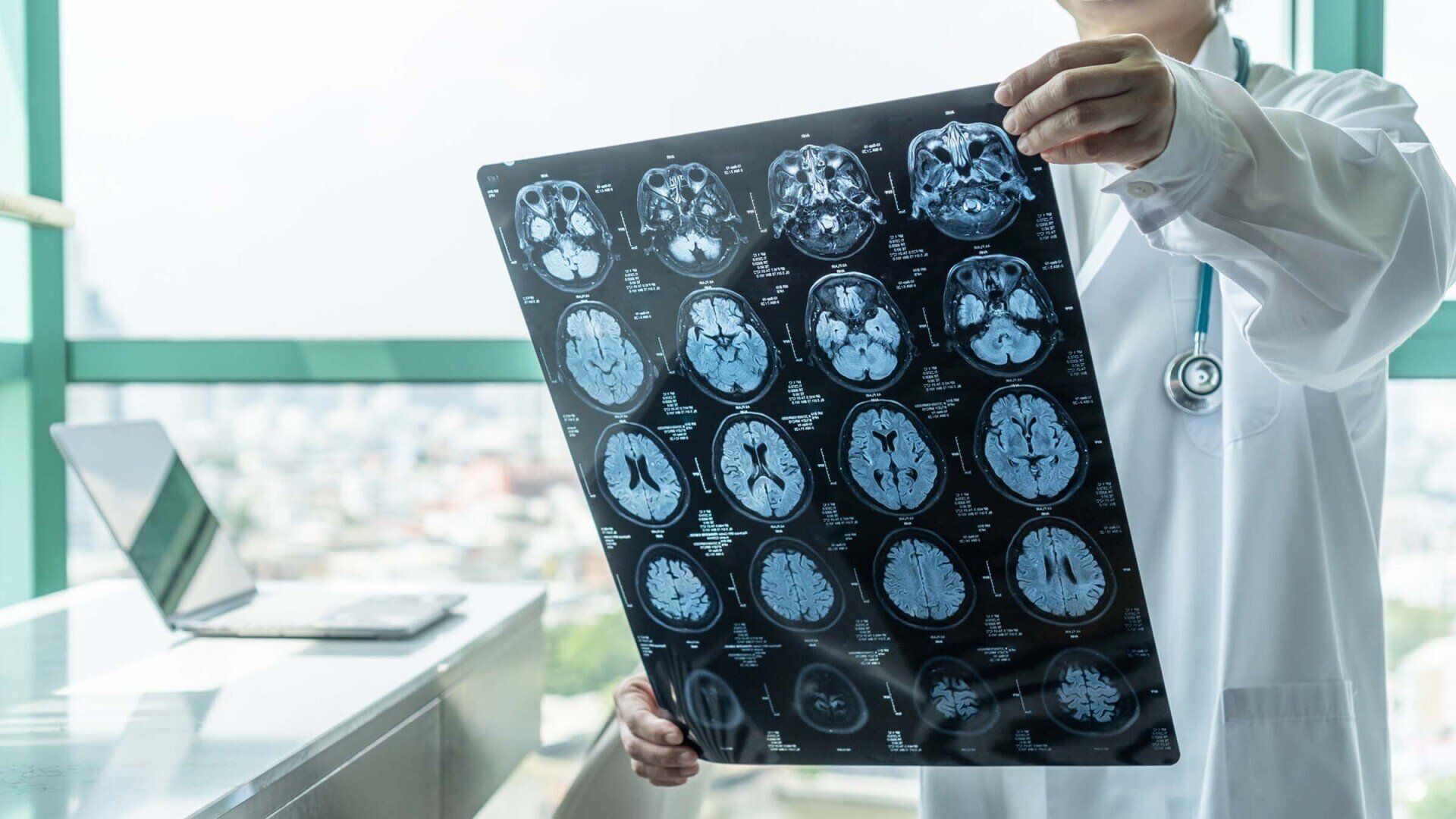 Doctor holding a brain scan, examining it in a well-lit office, with a laptop and city view in the background.