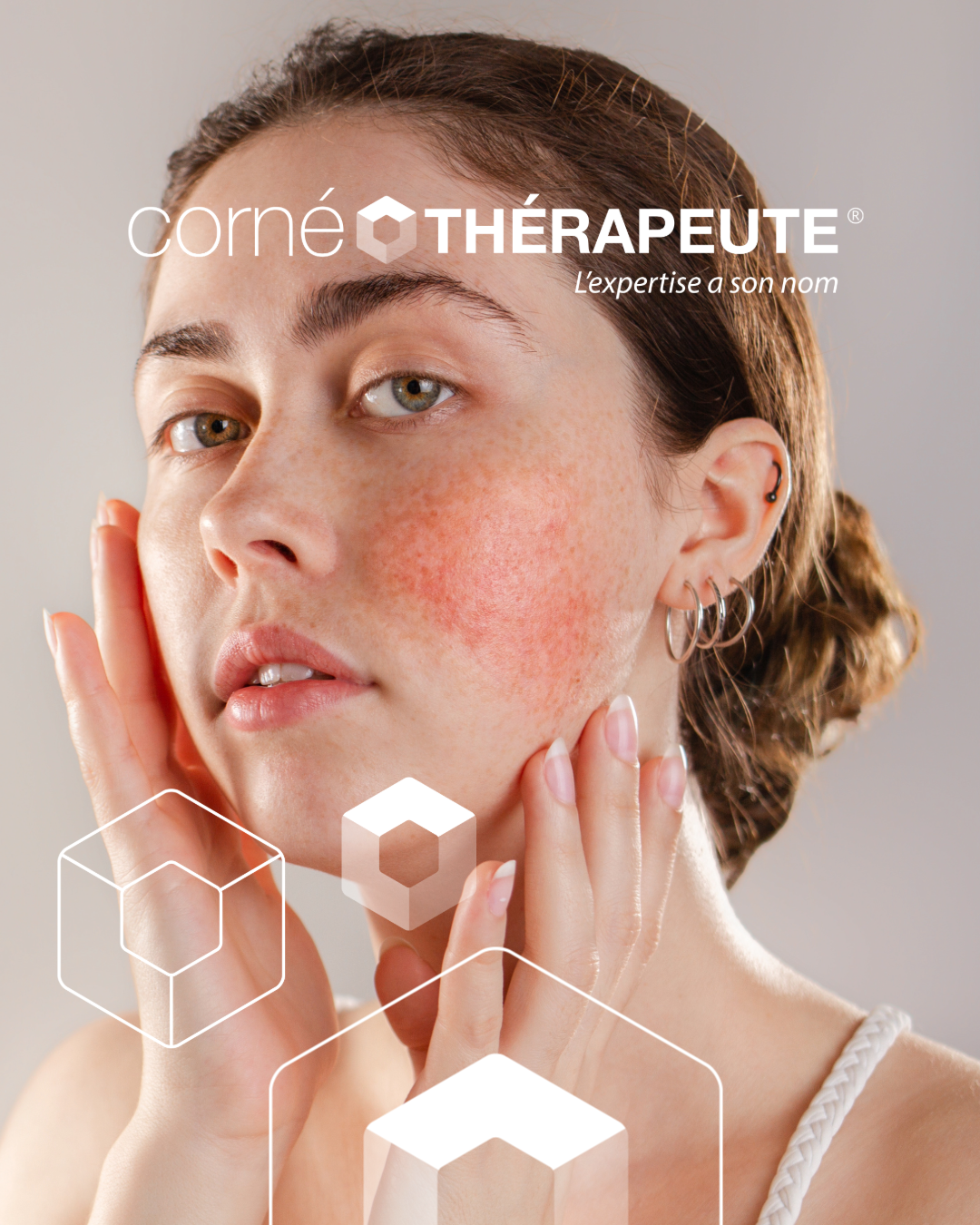 Femme au visage rouge, se touchant le visage. Logo dans le coin supérieur gauche, formes géométriques blanches.