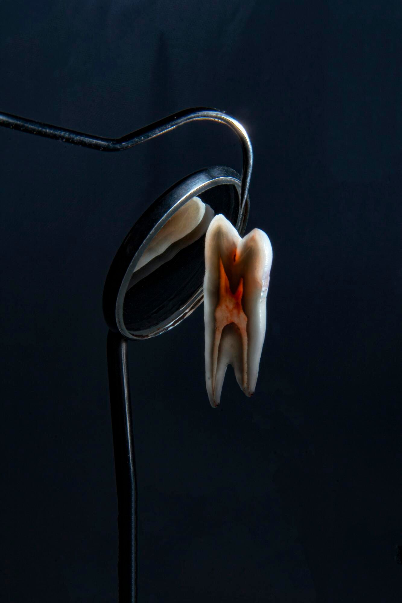 Dentist mirror reflecting a cracked tooth on a dark background