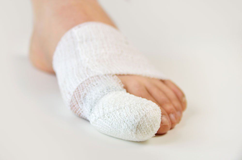 Foot After Surgery — Indianapolis, IN — Northeast Foot And Ankle Foot After Surgery — Indianapolis, IN — Northeast Foot And Ankle