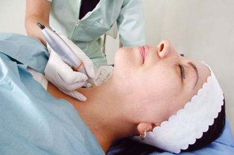 Micropuntura estética aplicada en piel con técnica profesional