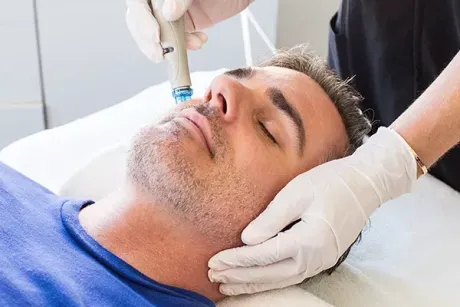 Aplicación de HydraFacial para limpieza e hidratación facial