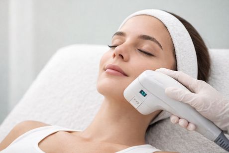 Tratamiento HIFU facial en beauty room de Guadalajara