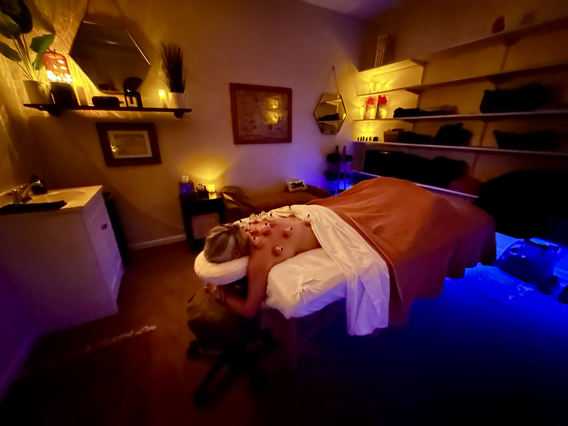 Cupping therapy cups on a person’s bare back during a massage treatment Cupping therapy cups on a person’s bare back during a massage treatment