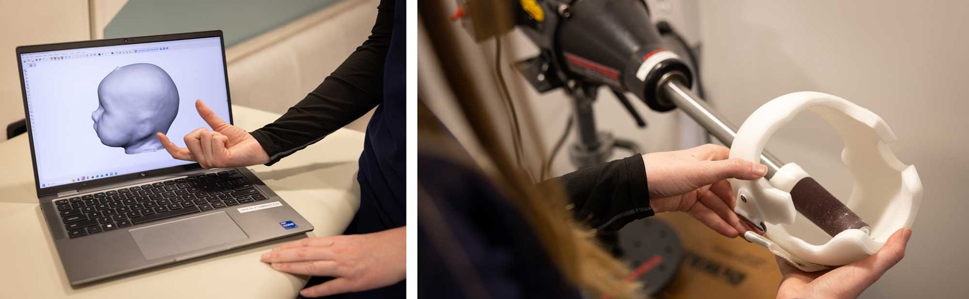 Hands using a laptop and a 3D scanner to capture a white model skull on a desk.