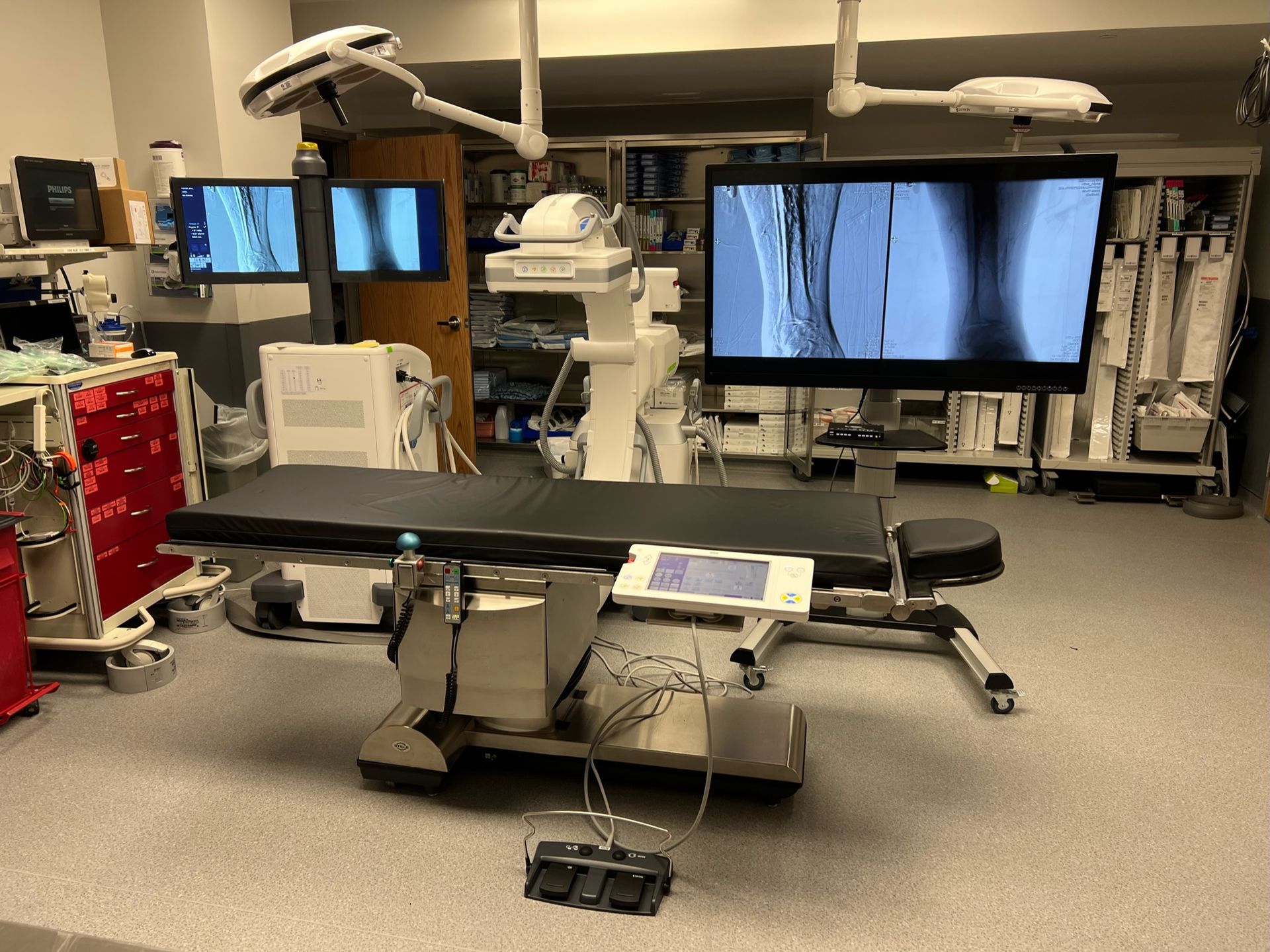 Mobile angiography lab equipped for on-site cardiac procedures
