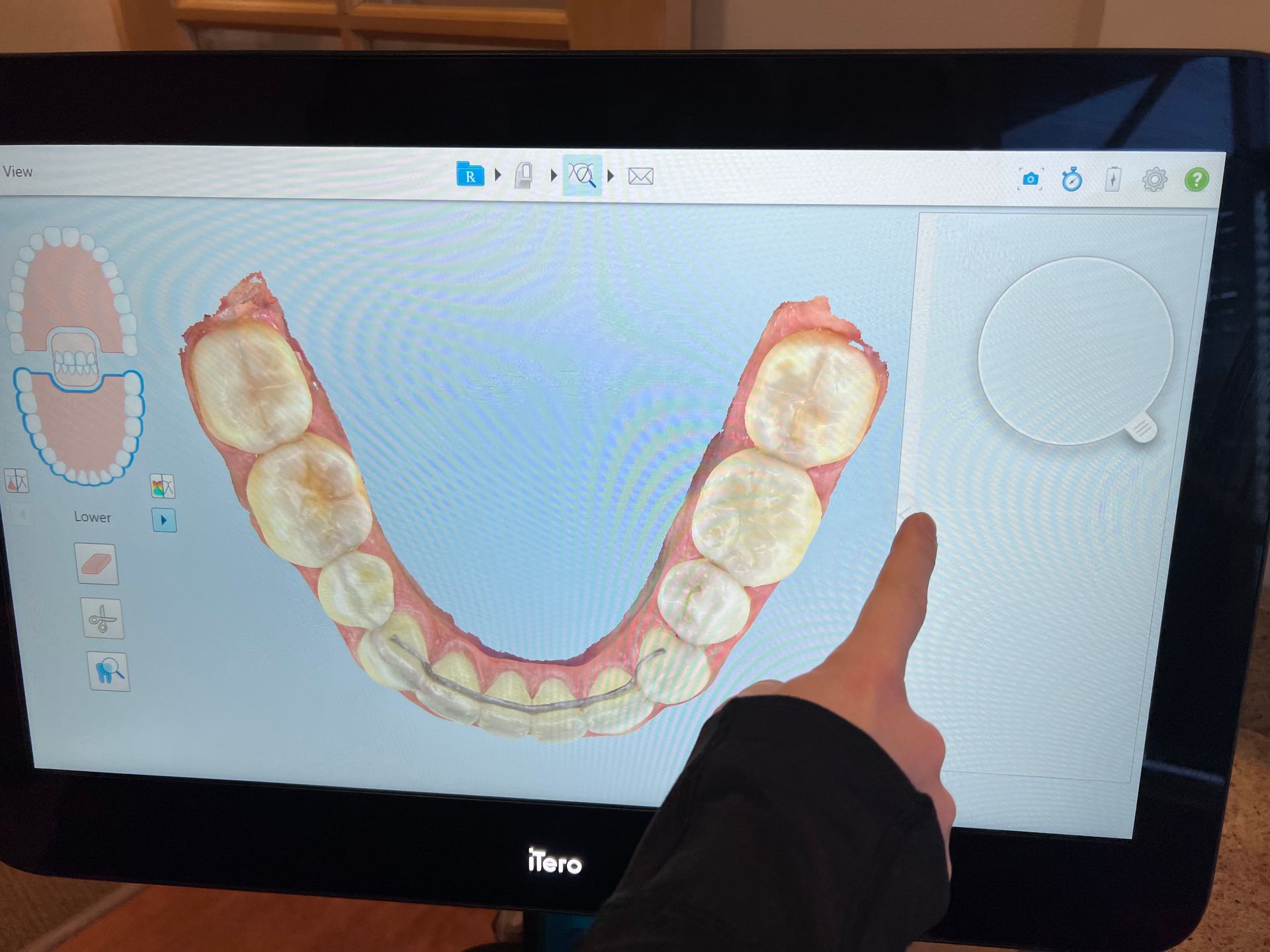 Digital Dentures | Kodiak, AK | Kodiak Island Family Dentistry Digital Dentures | Kodiak, AK | Kodiak Island Family Dentistry