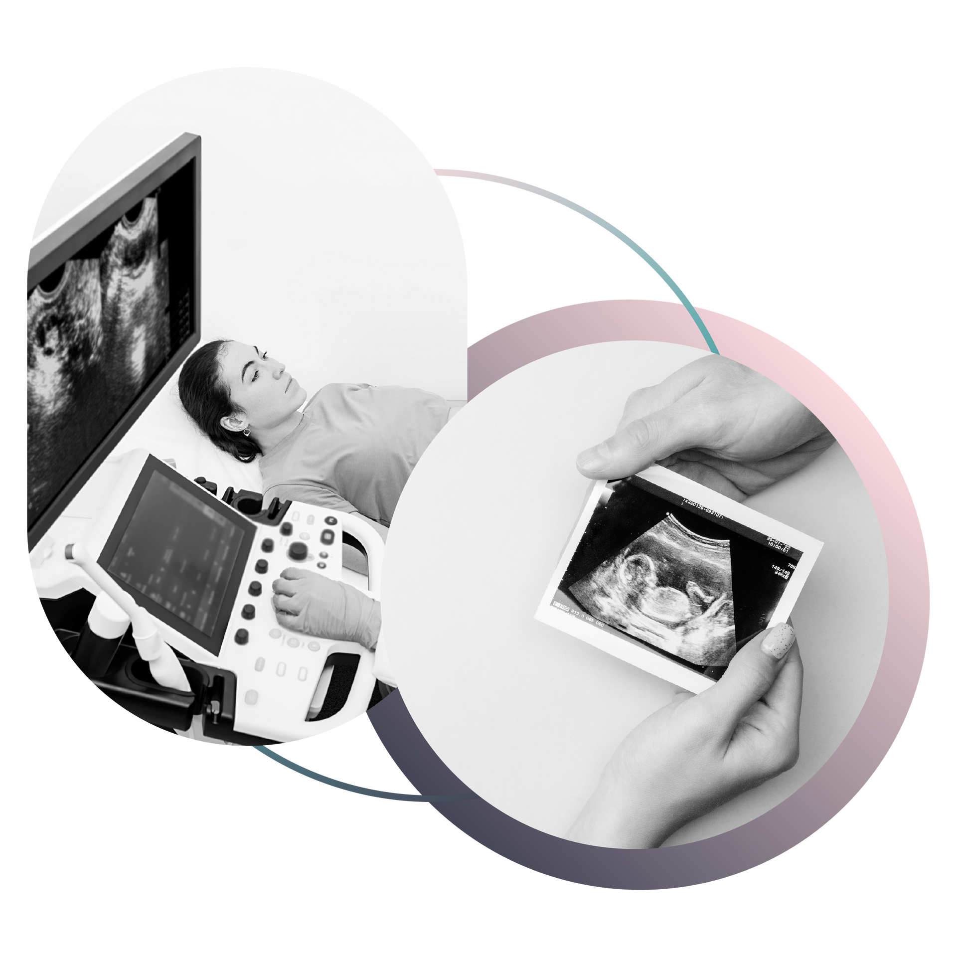 Black and white image showing woman having an ultrasound and hands holding a printed ultrasound photo.