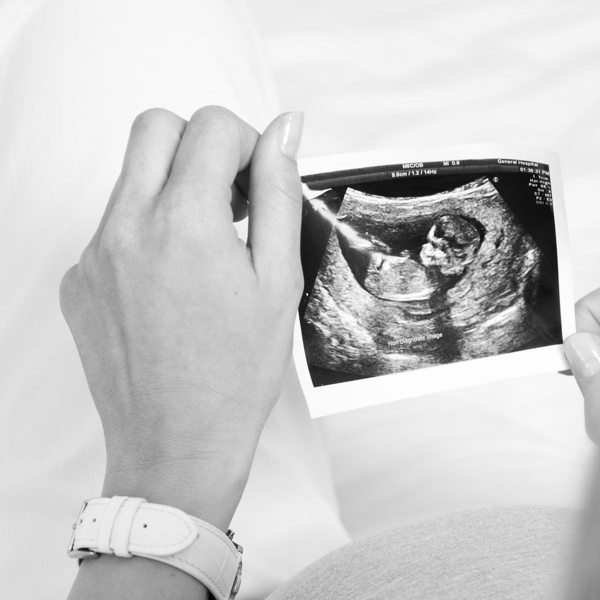 Pregnant woman holding an ultrasound image while sitting and looking at the scan of her baby.