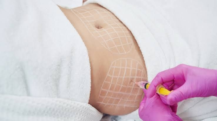 Provider administering LipoDissolve injections to a patient’s abdomen