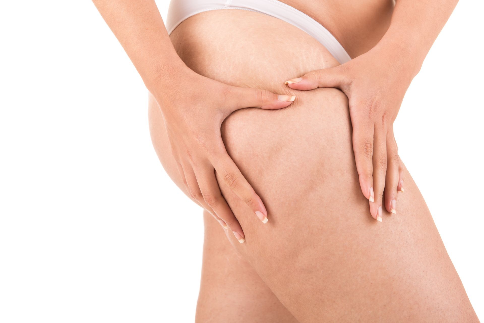 Person pinching skin on thigh, showing visible cellulite.