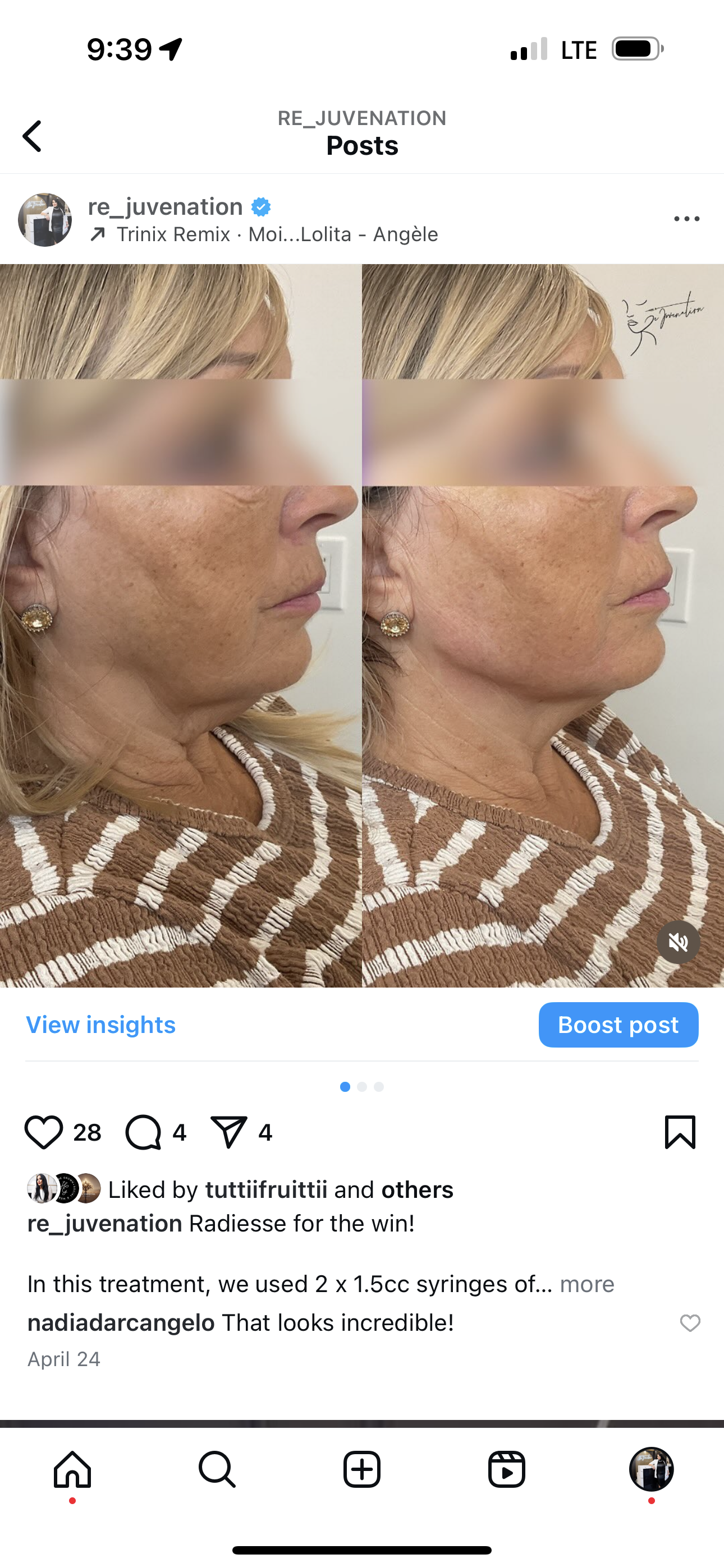 A before and after photo of a woman 's face on a cell phone.