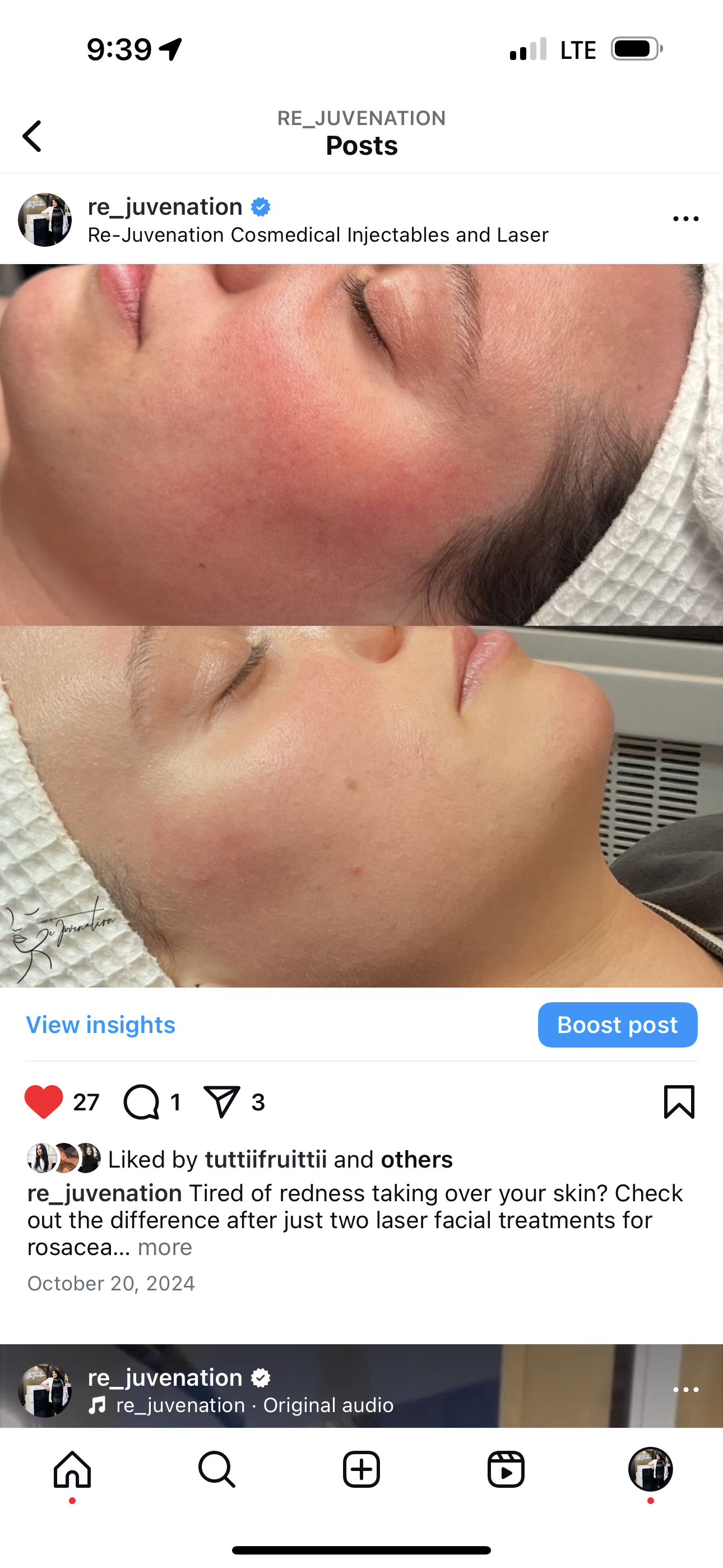 A woman is getting a facial treatment on her face.