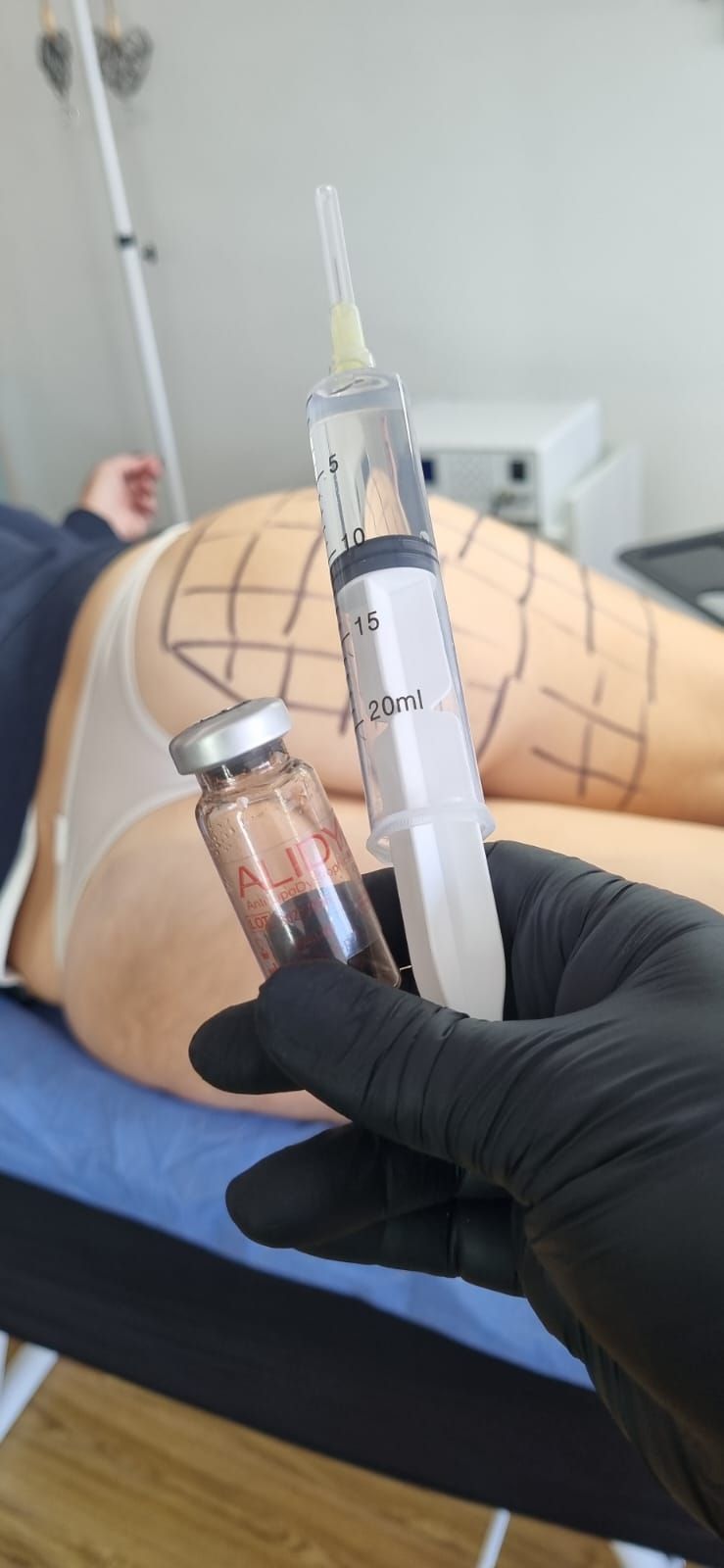 Una mano enguantada sostiene una jeringa y un vial de sangre cerca de un brazo tatuado sobre una camilla de exploración.