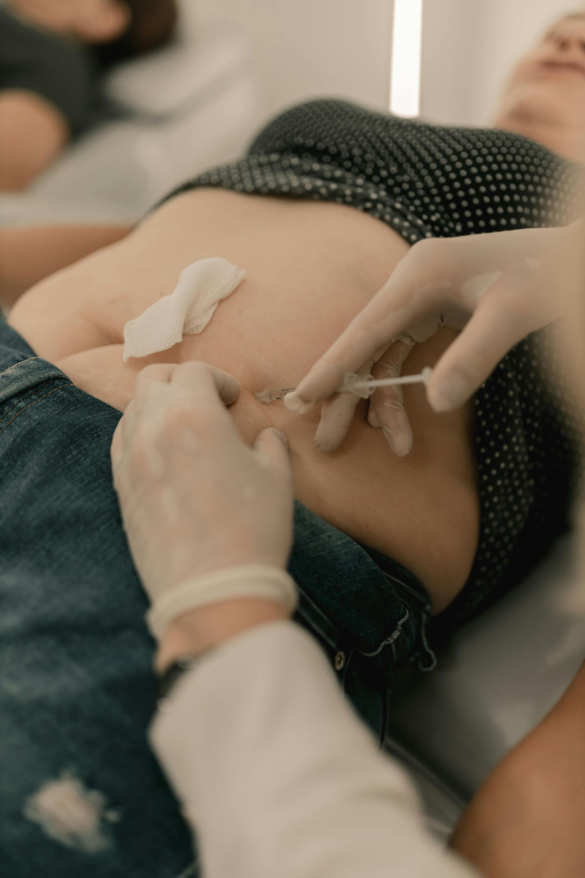 Profesional médico insertando una vía intravenosa en el abdomen de un paciente durante un procedimiento.