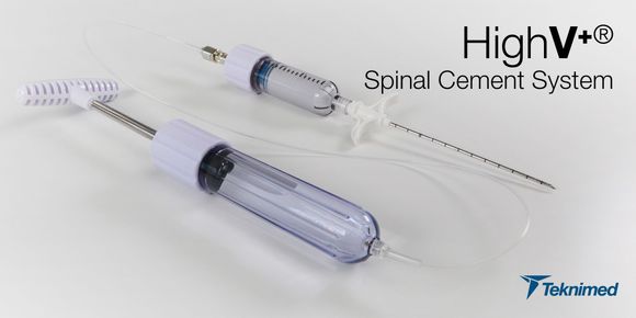 Set per il sistema di cemento spinale HighV+, comprendente una siringa per somministrazione manuale, un tubicino per iniezione e un ago su sfondo bianco.