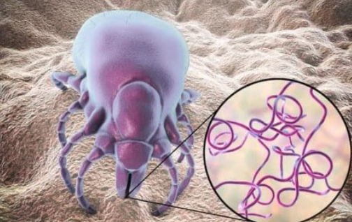 Microscopic image of a tick and a magnified view of spiral-shaped bacteria it carries; purple and tan colors.