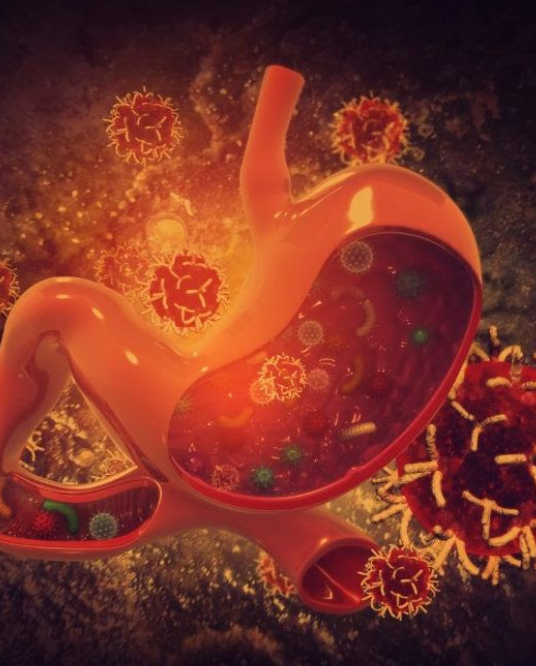 Illustration of a stomach with harmful bacteria inside, depicted in red and orange tones, indicating infection.