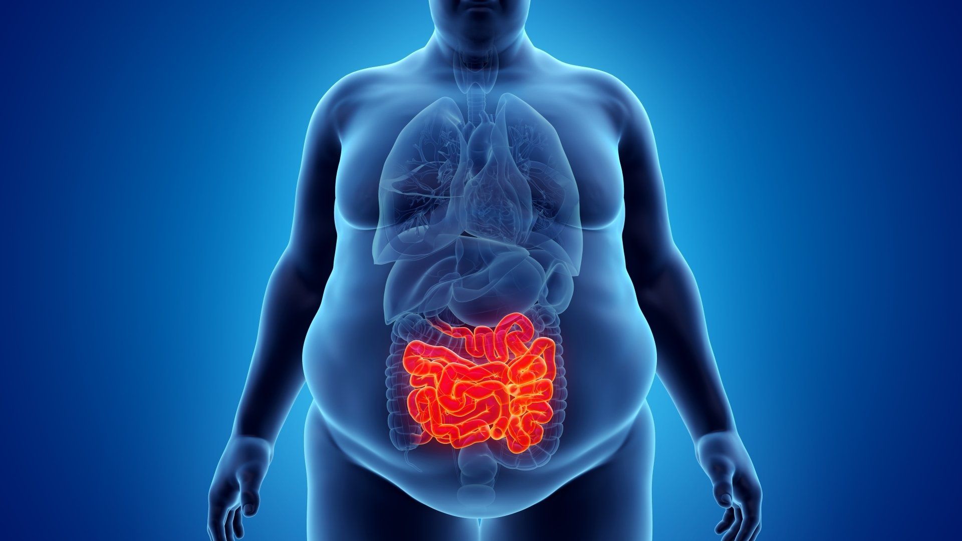 Illustration of an obese person with the small intestine highlighted in red.