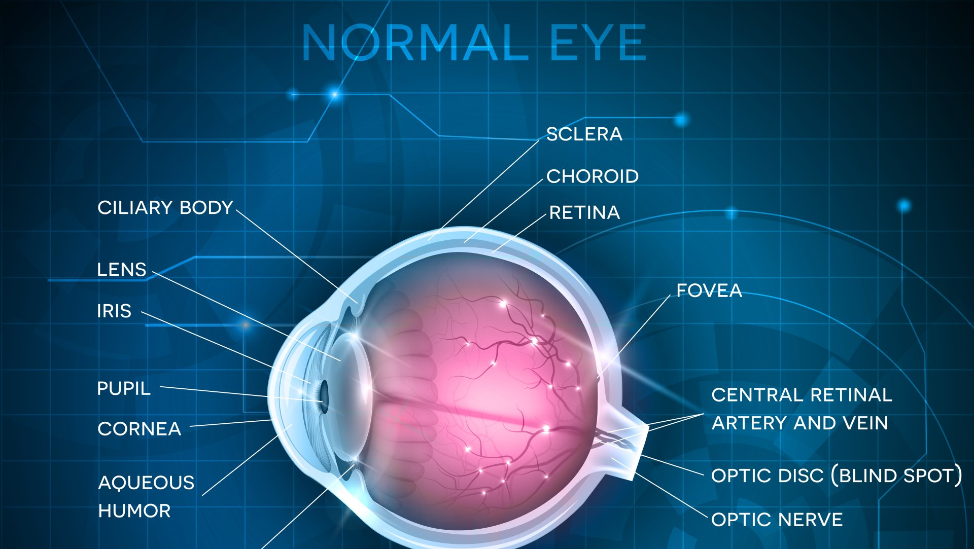 Diagram of a normal eye, labeled with parts such as cornea, lens, retina, optic nerve, and others.