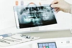 CIRUJANOS DENTISTAS CASTRO ROMO - CORONAS CIRUJANOS DENTISTAS CASTRO ROMO - CORONAS
