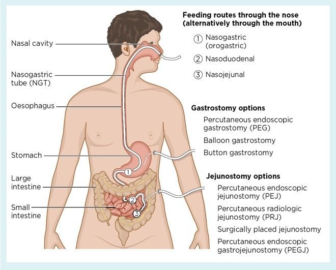 Illustration of a body with the gastrointestinal tract identified