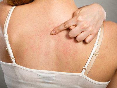 DR. LUIS GÓMEZ REZA - DERMATOLOGÍA