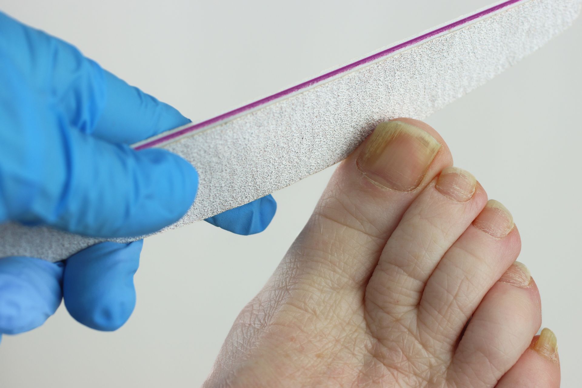 Gloved hand filing toenails with a white emery board on a foot